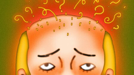 Why Are You Losing So Much Hair? Here’s What to Know Close-up of a hairbrush with loose strands collected in the bristles